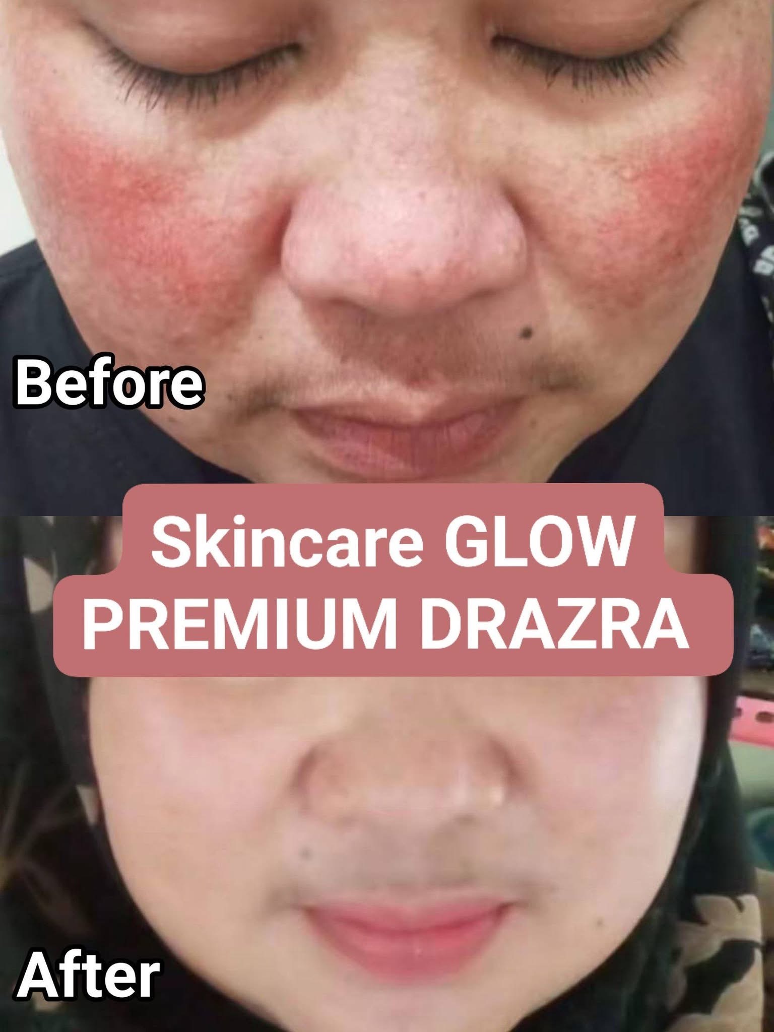 Testimoni DRAZRA 1
