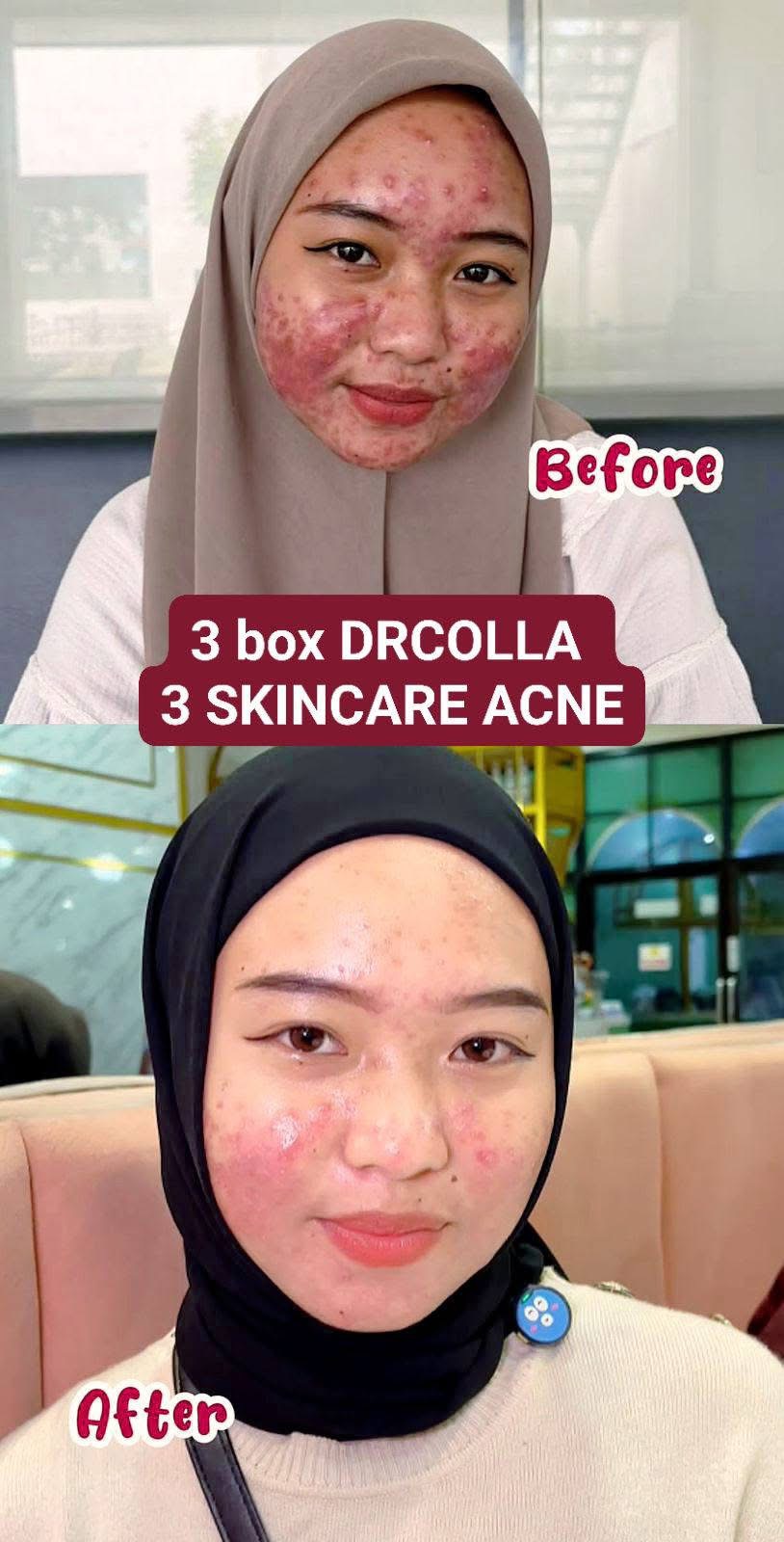 Testimoni DRAZRA 3