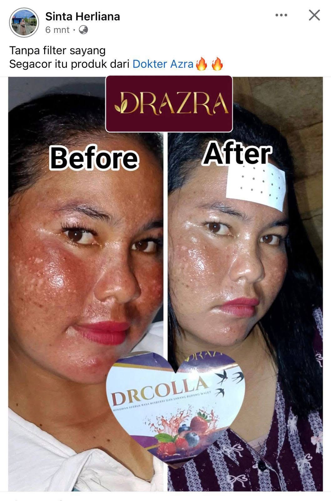 Testimoni DRAZRA 5
